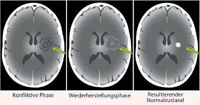 Ablauf Hirn-CT