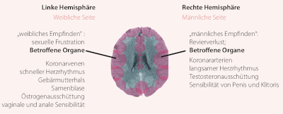 Hemisphaeren